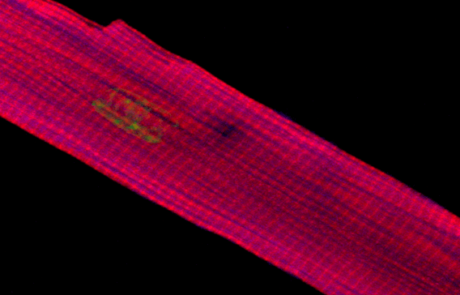Measuring Work in Single Isolated Cardiomyocytes: Replicating the Cardiac Cycle
