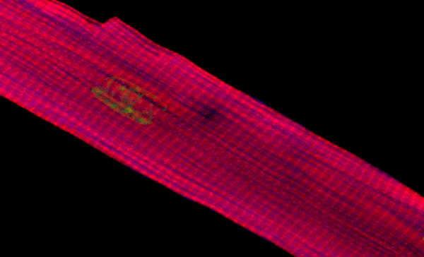 Measuring Work in Single Isolated Cardiomyocytes: Replicating the Cardiac Cycle