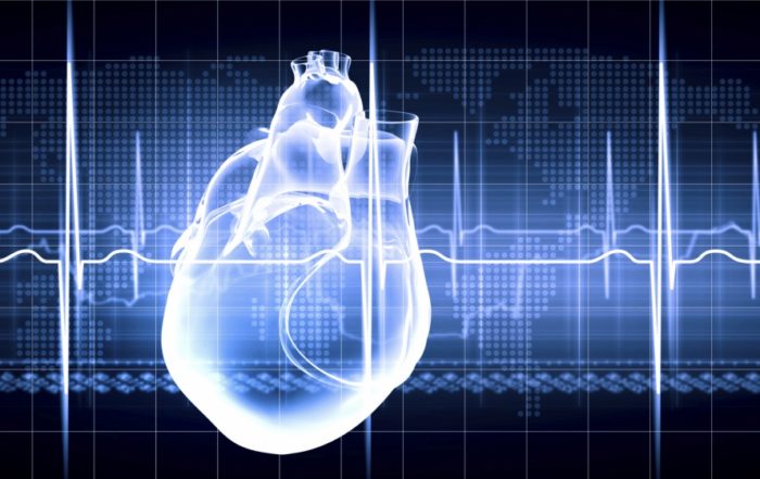 Improving Preclinical and Clinical Regulatory Submissions Through Enhanced ECG Interval and Arrhythmia Assessment