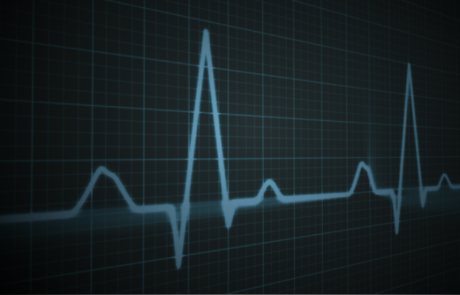 Don’t Miss a Beat: Arrhythmia Detection for Preclinical ECG Research