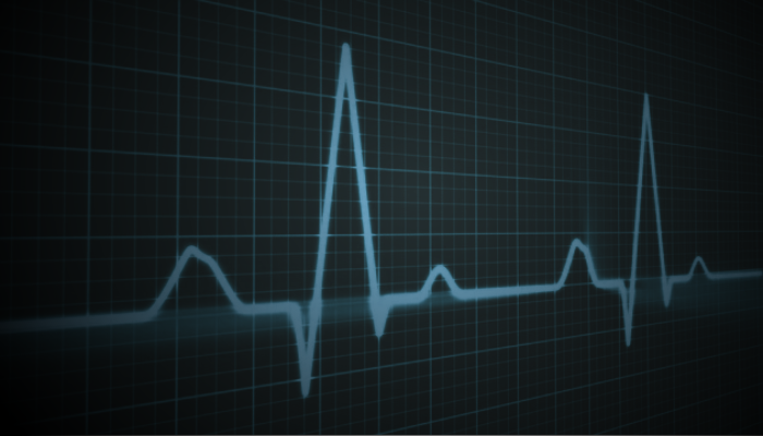 Don't Miss a Beat: Arrhythmia Detection for Preclinical ECG Research