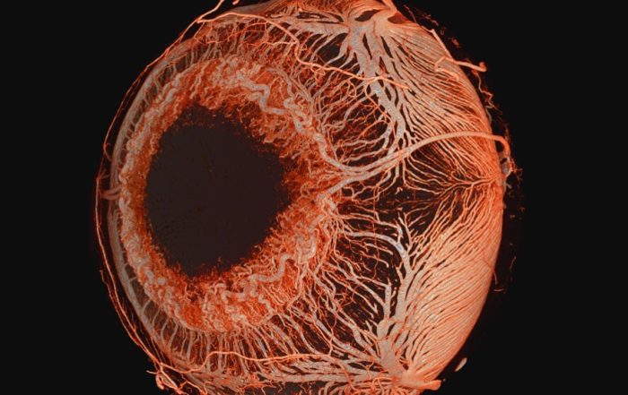 Ex Vivo MicroangioCT: Advances in Microvascular Imaging