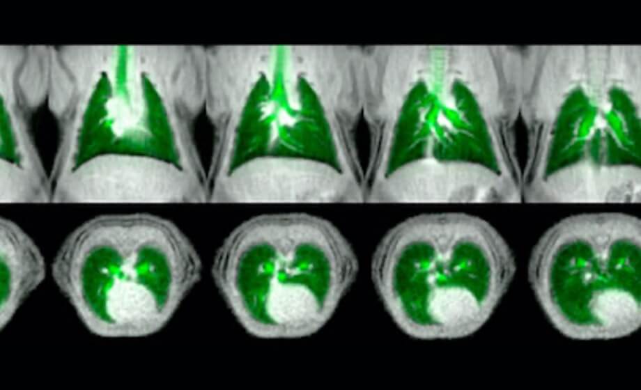 Hyperpolarized Xe MRI of Pulmonary Gas-Exchange in Rodents