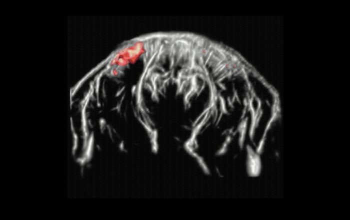 Functional Ultrasound (fUS) Imaging in the Brain of Awake Behaving Mice