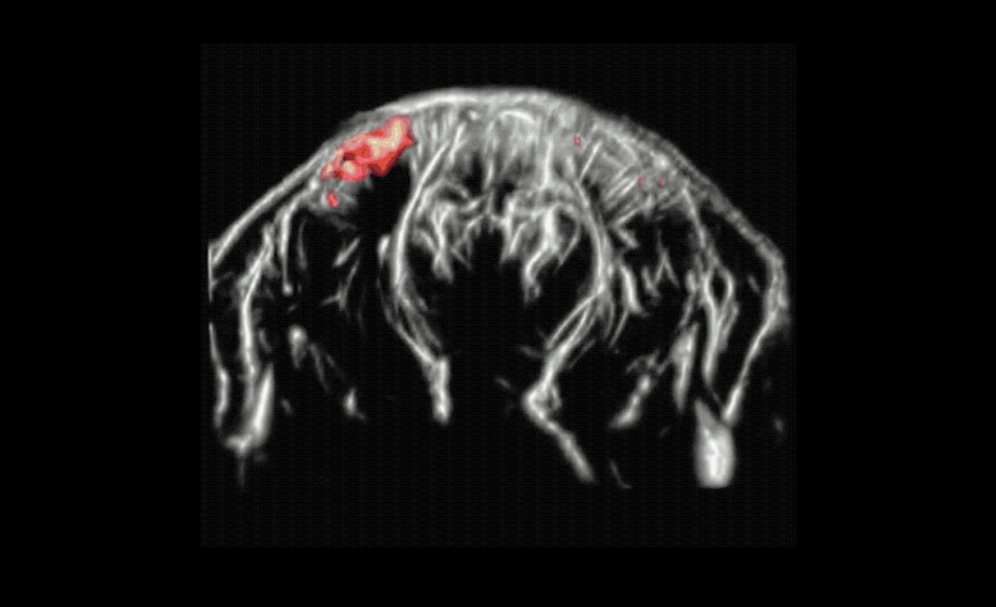 Functional Ultrasound (fUS) Imaging in the Brain of Awake Behaving Mice