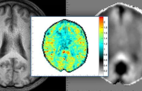 Magnetic Resonance Elastography (MRE): Techniques and Preclinical Applications