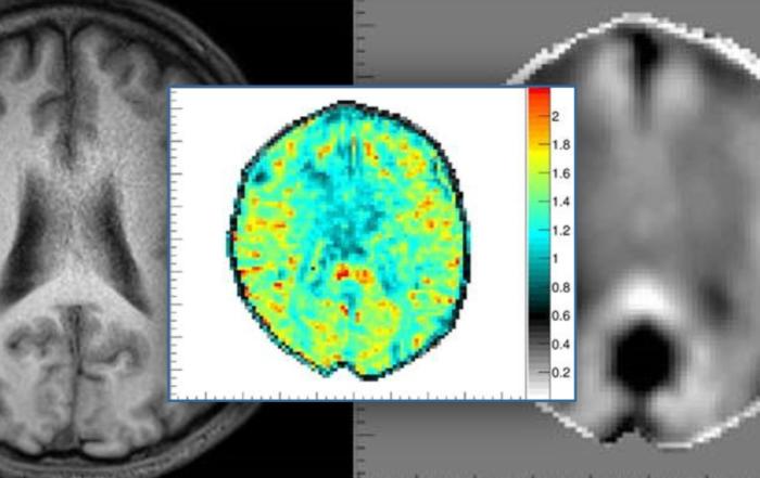 Magnetic Resonance Elastography (MRE): Techniques and Preclinical Applications