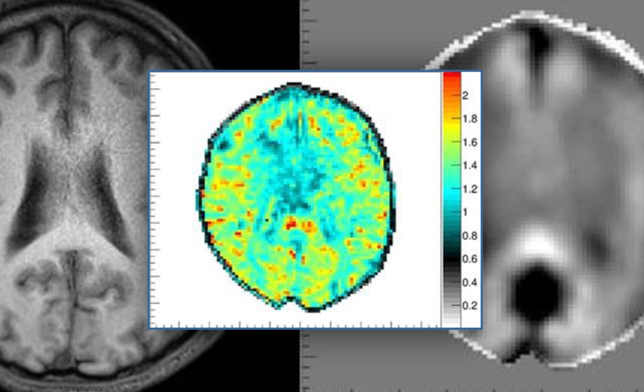 Magnetic Resonance Elastography: Techniques and Preclinical Applications