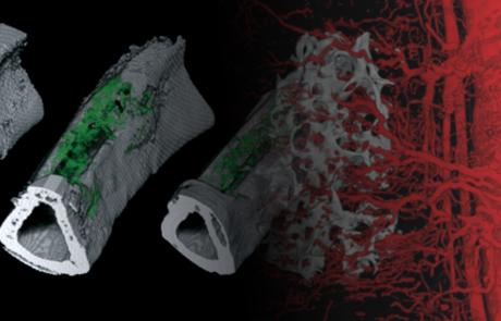 High-Resolution Exploration of ECM-based Vascularized Tissue-Flaps