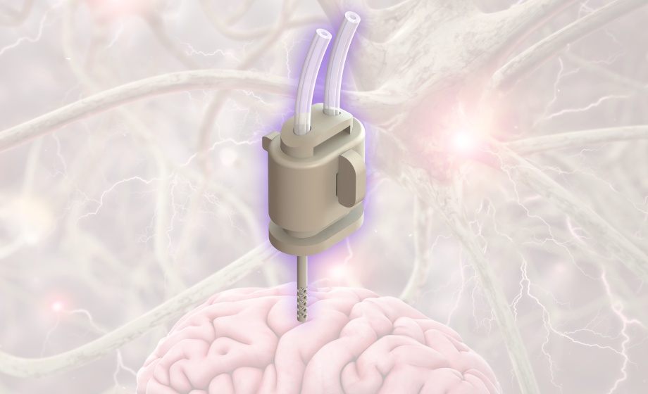 Cerebral Open Flow Microperfusion (cOFM) for In Vivo Long-Term Cerebral Fluid Sampling