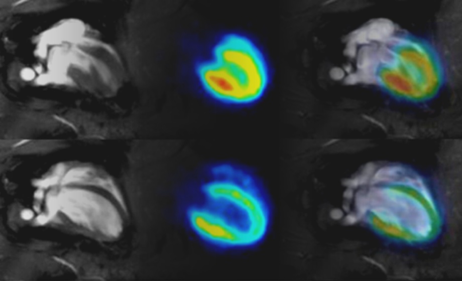 Cardiac PET/MR Imaging in Small Rodents: Cardiac & Respiratory Gating and Streamlined PET & MRI Analysis