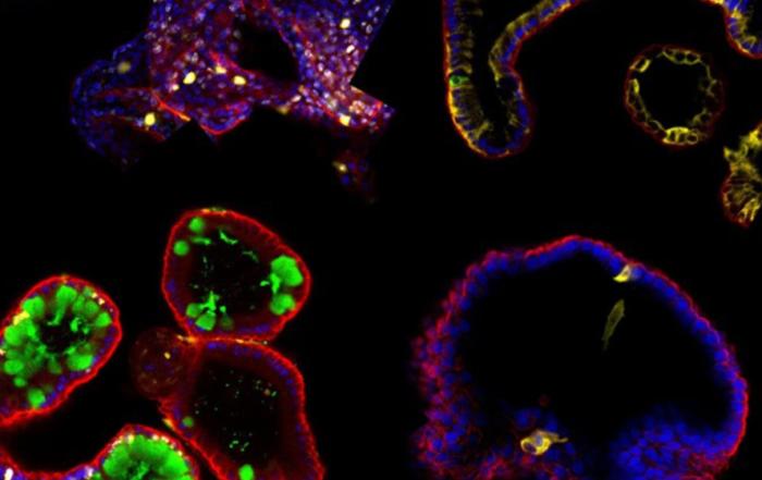 Intestinal Toxicity Assessment with Patient-Derived Organoids