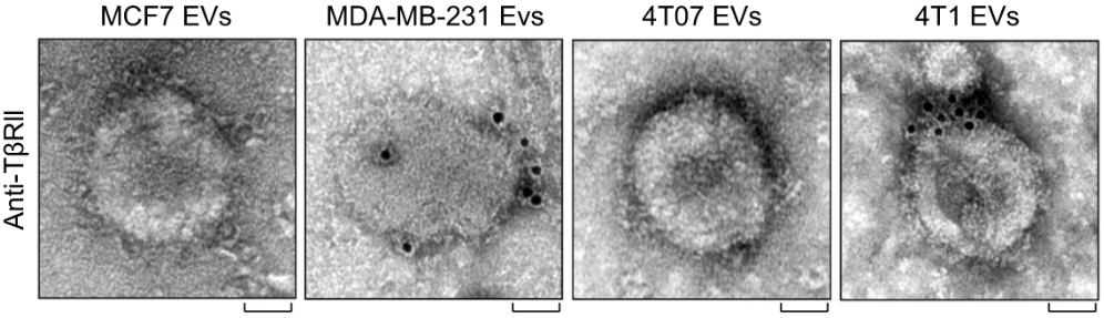 TEM images of breast cancer cell line-derived extracellular vesicles