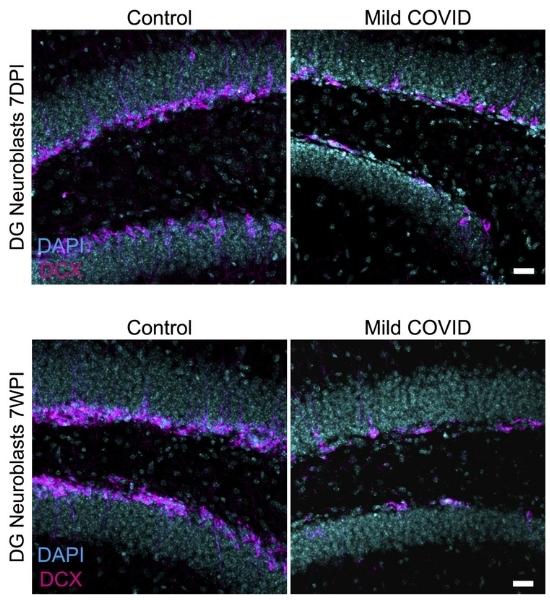Decrease in new neuron generation following mild COVID