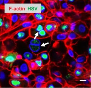 HSV infection in the epidermis of skin-on-chip