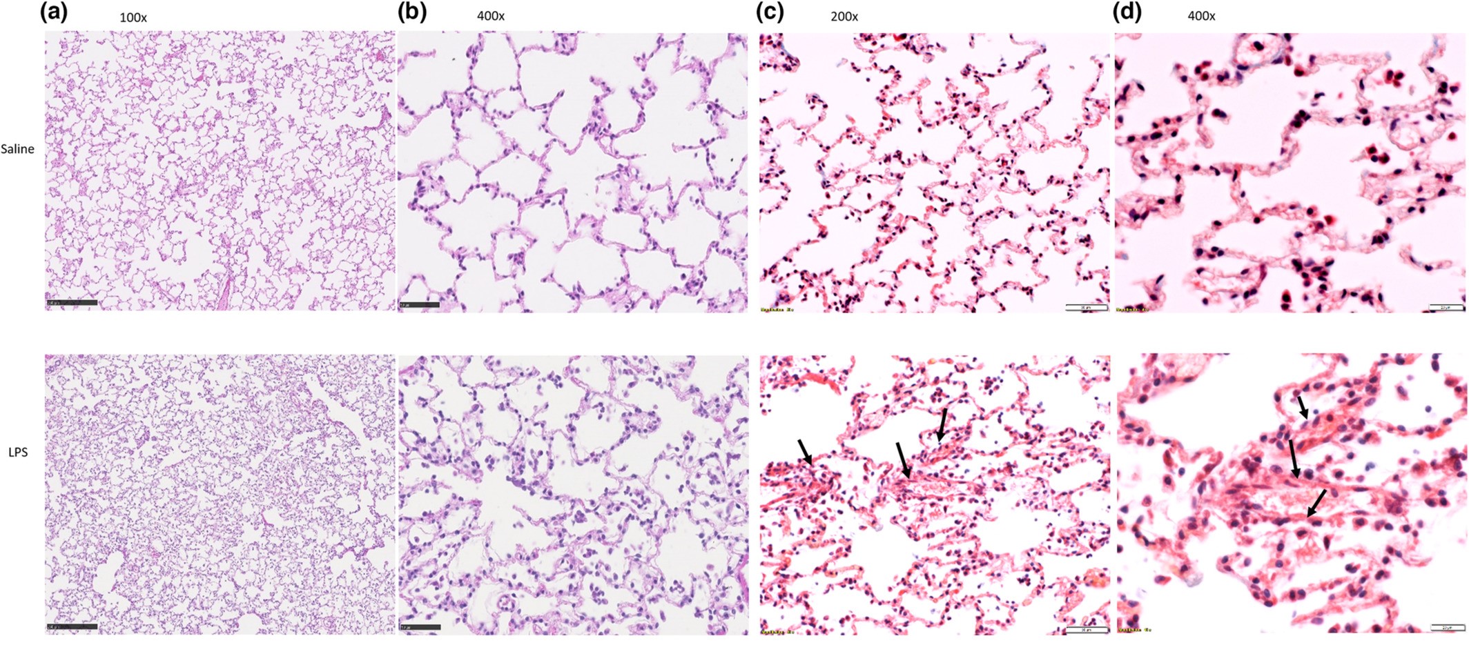 Lung histological changes in ferrets following saline and/or LPS administration