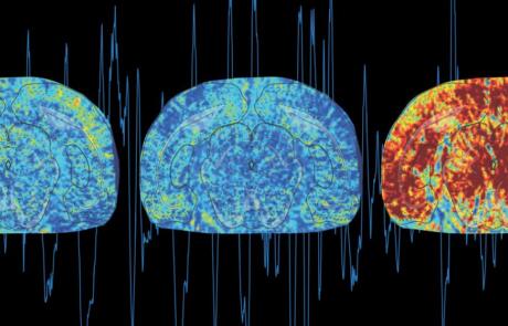 Multimodal Neuroimaging Using Functional Ultrasound (fUS)