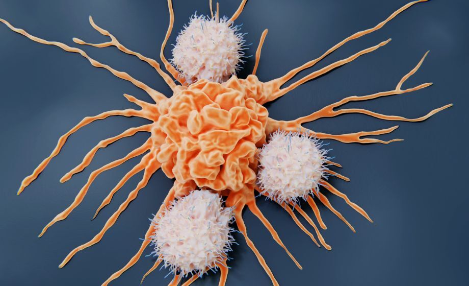 Cancer cell being attacked by immune cells