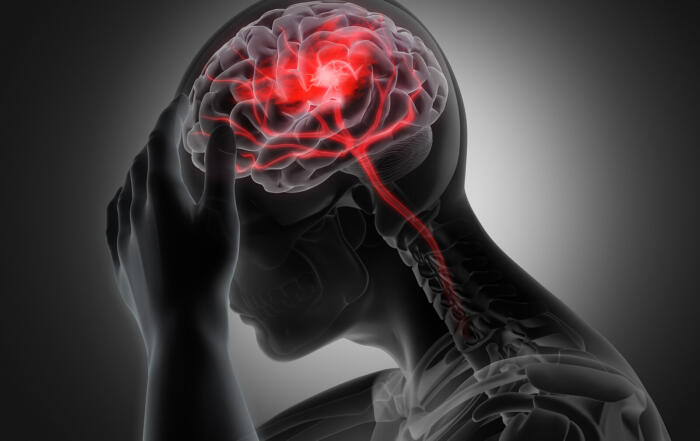 How High-Impact Sports Affect Brain Health: Chronic Traumatic Encephalopathy (CTE)