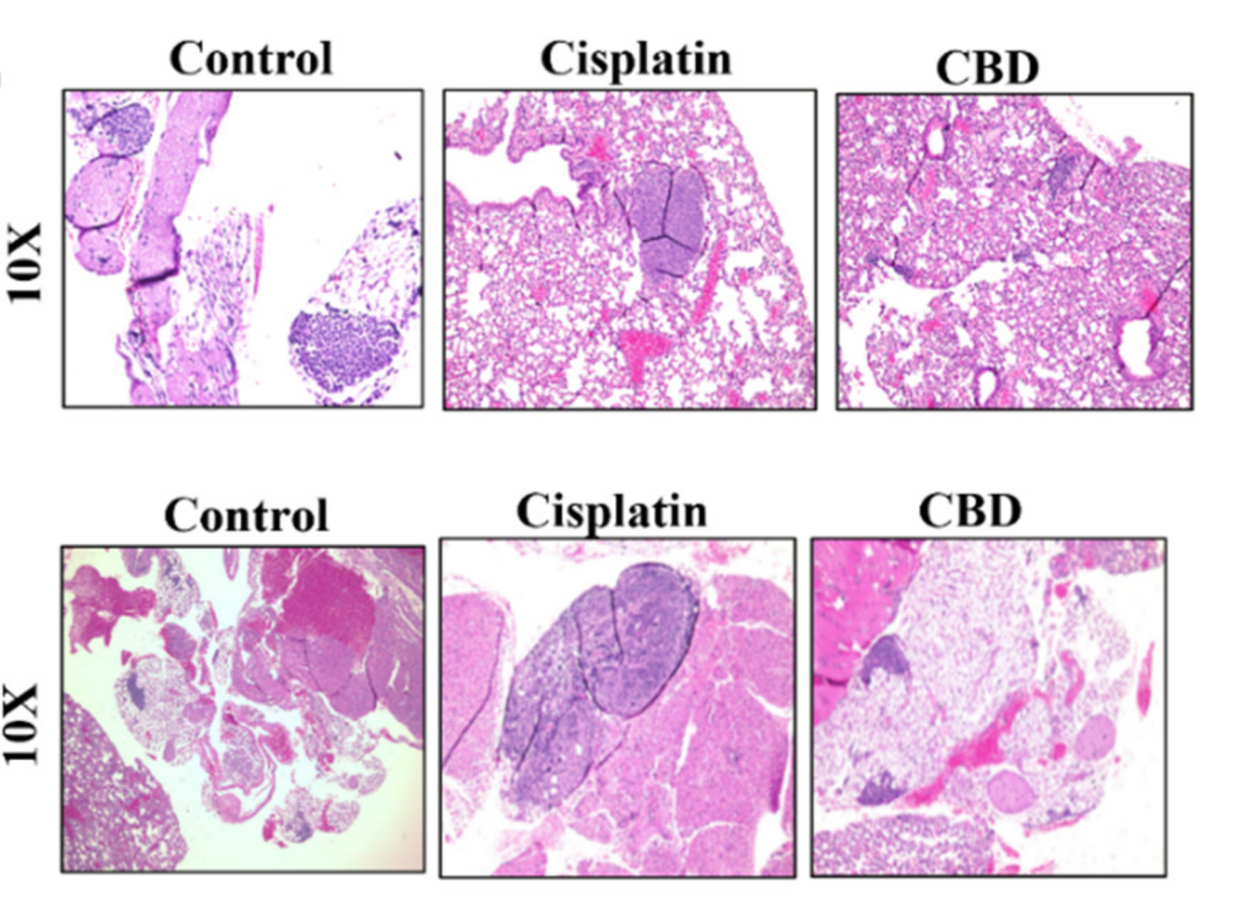 H&E staining of non-small cell lung tissue treated with a vehicle control, cipslatin, or CBD.