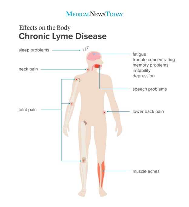 Summary of the various symptoms of chronic Lyme disease.