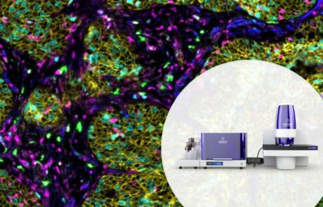 Spatial Phenotyping: A Revolutionary Approach to Biomarker Discovery for Cancer Immunotherapy